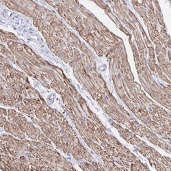 RHOBTB2 Antibody, Novus Biologicals:Antibodies:Primary Antibodies